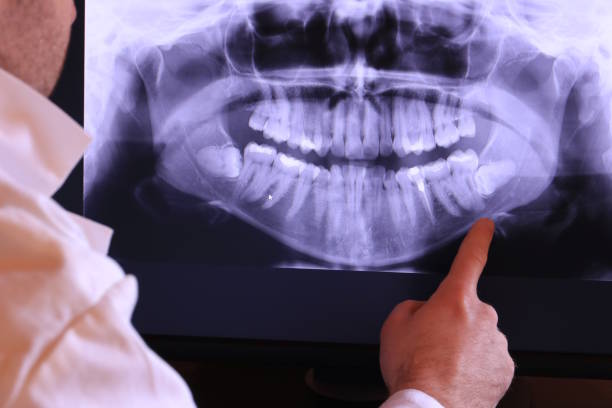 Best Emergency Dentist for Knocked-Out Tooth in Siloam Springs, AR