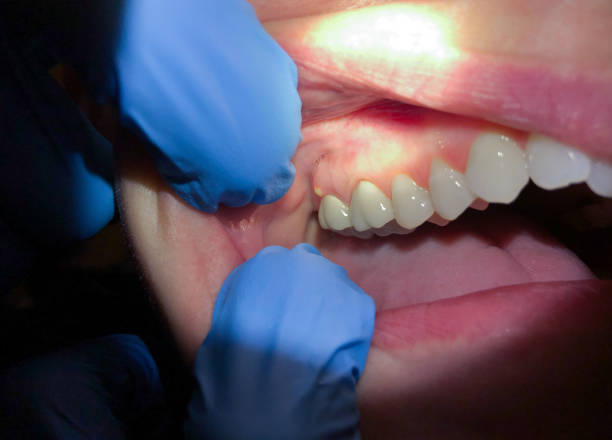 Best Orthodontic Emergency Dentist in Siloam Springs, AR