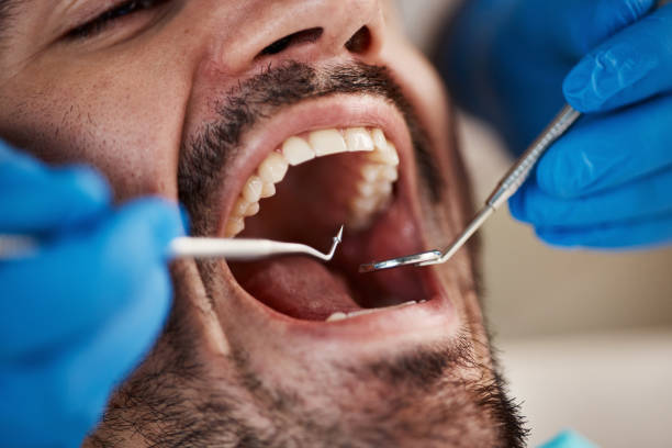 Best Emergency Dental Extractions in Siloam Springs, AR